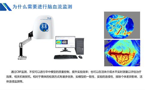 为什么需要进行脑血流监测？